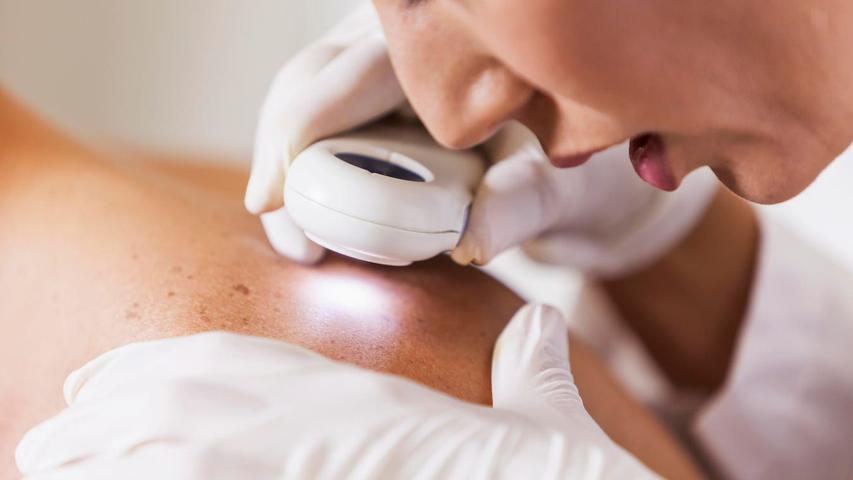 Scientists Made a Special Vaccine for Skin Cancer