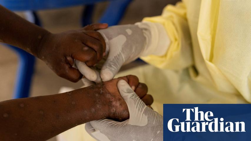 Congo's Unidentified Illness: Malaria a Factor?