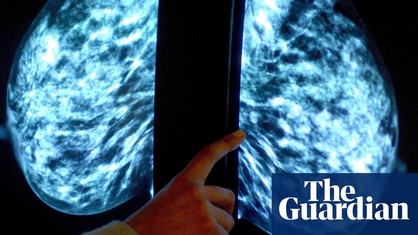 New Breast Cancer Screening for Younger Women?