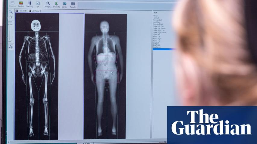 Full-Body Scans: A Medical Breakthrough