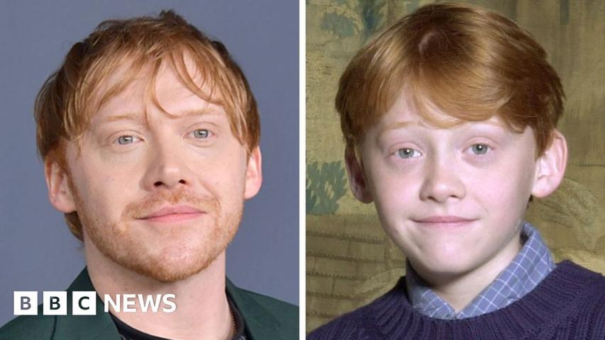 Ron Weasley's Actor Isn't Worried!