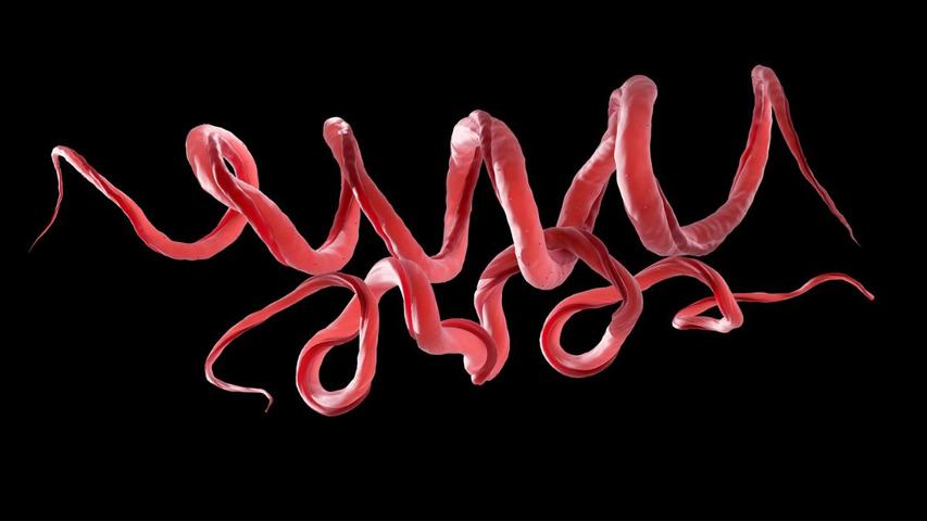 Syphilis's Ancient American Origins Uncovered