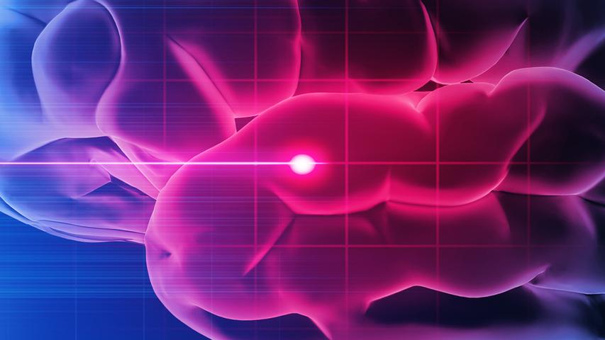 Magic Goo Helps Brains After Scary Strokes